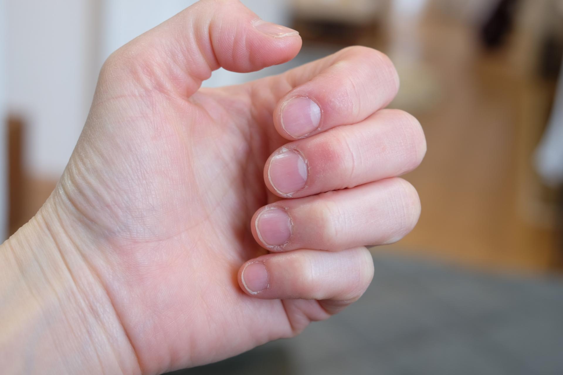 短い爪のケア | 神奈川県二子新地のネイルならNail Atelier Ñika